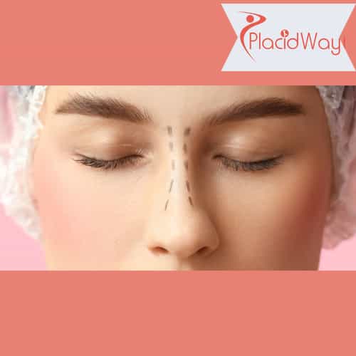 Rhinoplasty (Nose Surgery) in Turkey for Manchester Patients